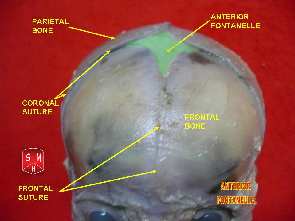 Fontanel