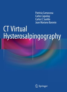 CT Virtual Hysterosalpingography