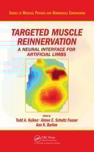 Targeted Muscle Reinnervation