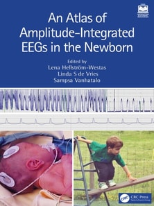 Atlas of Amplitude-Integrated EEGs in the Newborn