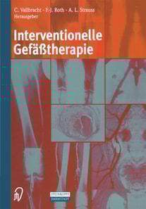Interventionelle Gefäßtherapie