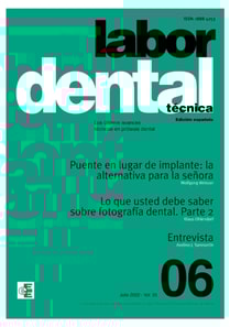 Labor Dental Técnica Nº6 Vol.25