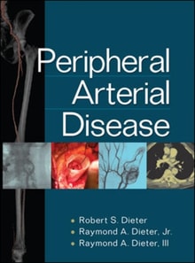Peripheral Arterial Disease