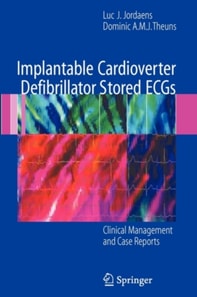 Implantable Cardioverter Defibrillator Stored ECGs