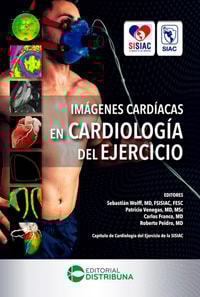Imágenes Cardíacas en Cardiología del Ejercicio