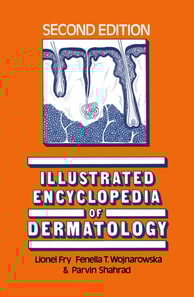 Illustrated Encyclopedia of Dermatology