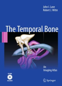 Temporal Bone