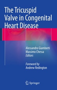 Tricuspid Valve in Congenital Heart Disease