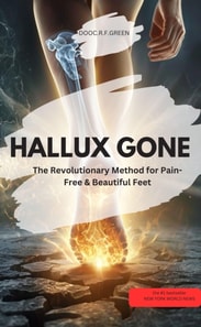 HALLUX GONE! – The Revolutionary Method for Pain-Free & Beautiful Feet