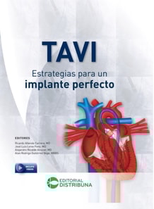 TAVI - Estrategias para un implante perfecto