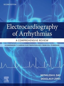 Electrocardiography of Arrhythmias: A Comprehensive Review E-Book