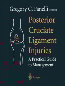 Posterior Cruciate Ligament Injuries