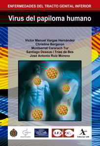 Virus del papiloma humano