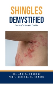 Shingles Demystified: Doctor's Secret Guide