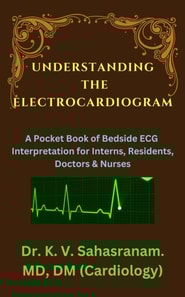 Understanding the Electrocardiogram