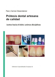 Prótesis dental artesanal de calidad