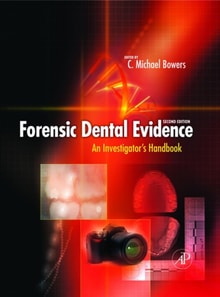 Forensic Dental Evidence
