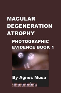 Macular Degeneration Atrophy, Photographic Evidence Book 1