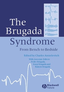 Brugada Syndrome