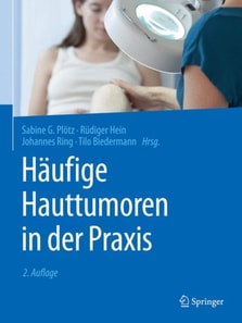 Häufige Hauttumoren in der Praxis
