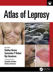 Atlas of Leprosy