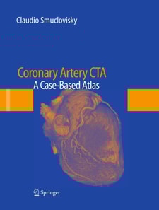 Coronary Artery CTA