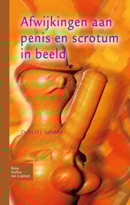 Afwijkingen aan penis en scrotum in beeld