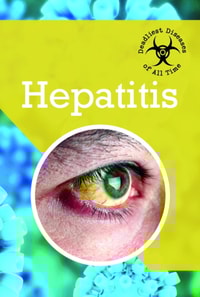 Hepatitis