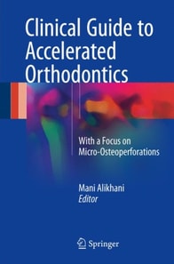 Clinical Guide to Accelerated Orthodontics