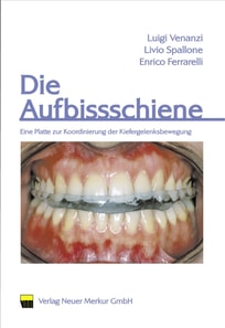 Die Aufbissschiene