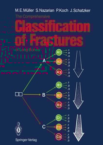 Comprehensive Classification of Fractures of Long Bones