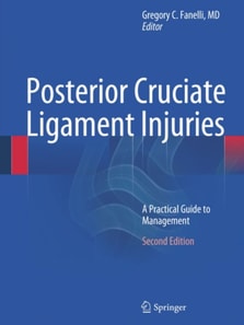 Posterior Cruciate Ligament Injuries