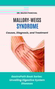 Mallory-Weiss Syndrome: Causes, Diagnosis, and Treatment