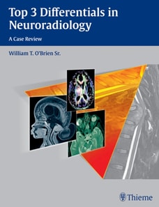 Top 3 Differentials in Neuroradiology