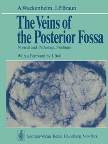 Veins of the Posterior Fossa