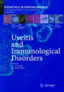 Uveitis and Immunological Disorders