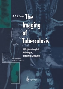 Imaging of Tuberculosis