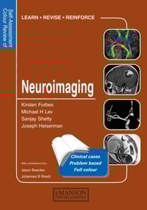 Neuroimaging