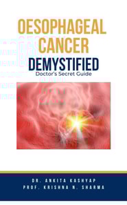 Oesophageal Cancer Demystified Doctors Secret Guide
