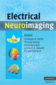 Electrical Neuroimaging