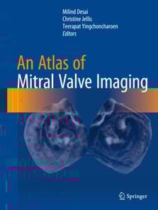 Atlas of Mitral Valve Imaging