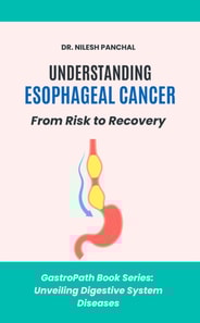 Understanding Esophageal Cancer: From Risk to Recovery