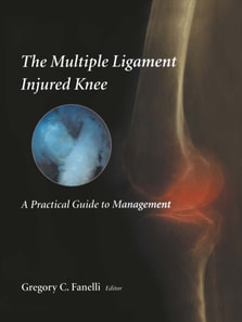 Multiple Ligament Injured Knee