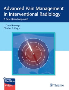 Advanced Pain Management in Interventional Radiology