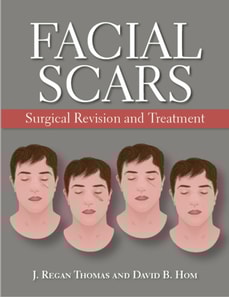 Facial Scars