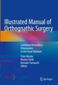 Illustrated Manual of Orthognathic Surgery