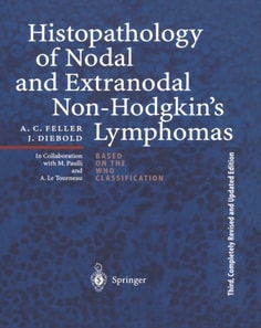 Histopathology of Nodal and Extranodal Non-Hodgkin's Lymphomas