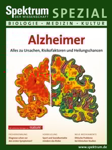 Alzheimer