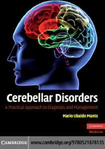 Cerebellar Disorders