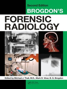 Brogdon's Forensic Radiology